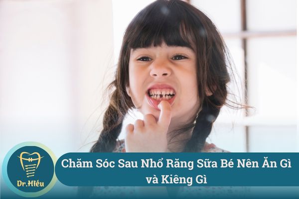 Cham Soc Sau Nho Rang Sua Be Nen An Gi va Kieng Gi De Het Dau Nhanh