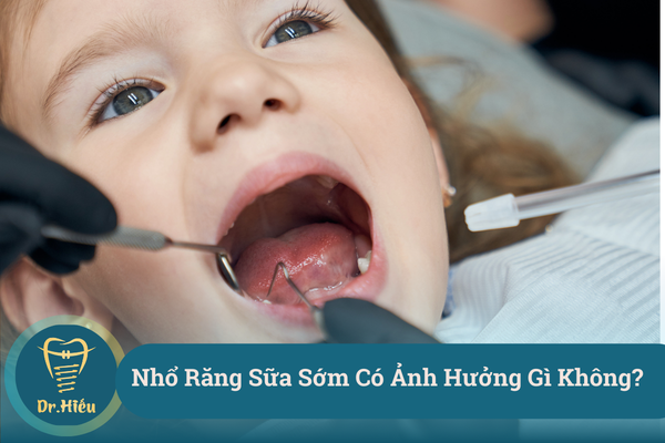 nho rang sua som co anh huong gi khong