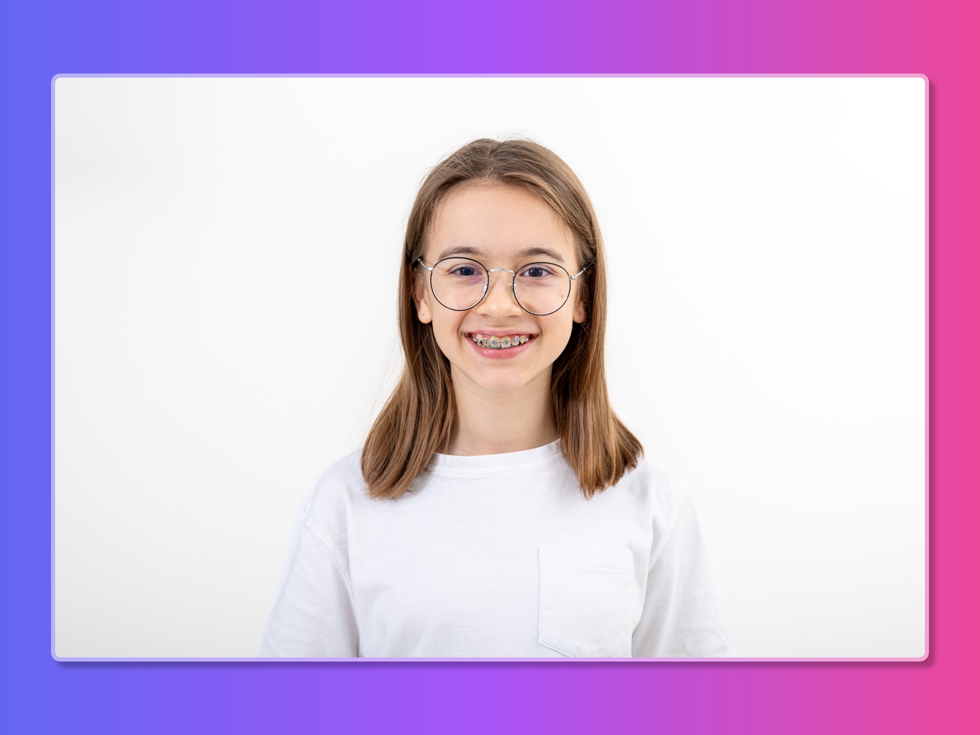 Những Sự Thật "Ít Người Dám Nói" Về Niềng Răng